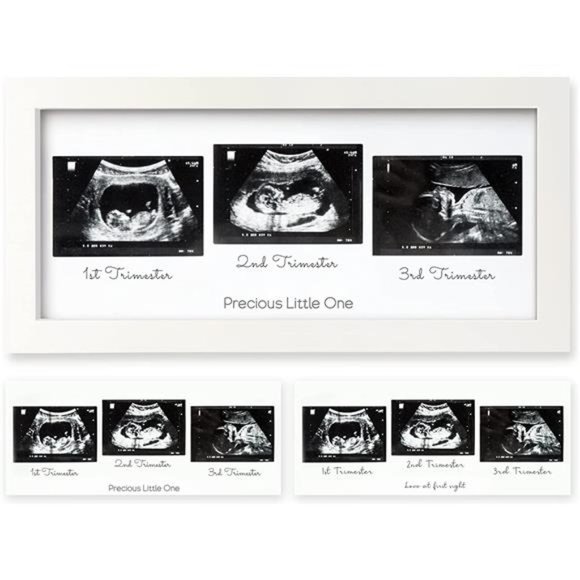 Sonogram Picture Frame - Trio Ultrasound Picture Frames  -  (Alpine White) - Picture 1 of 6